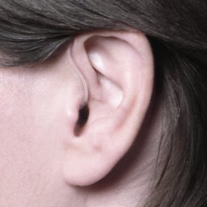 Ace Ear Picture 01